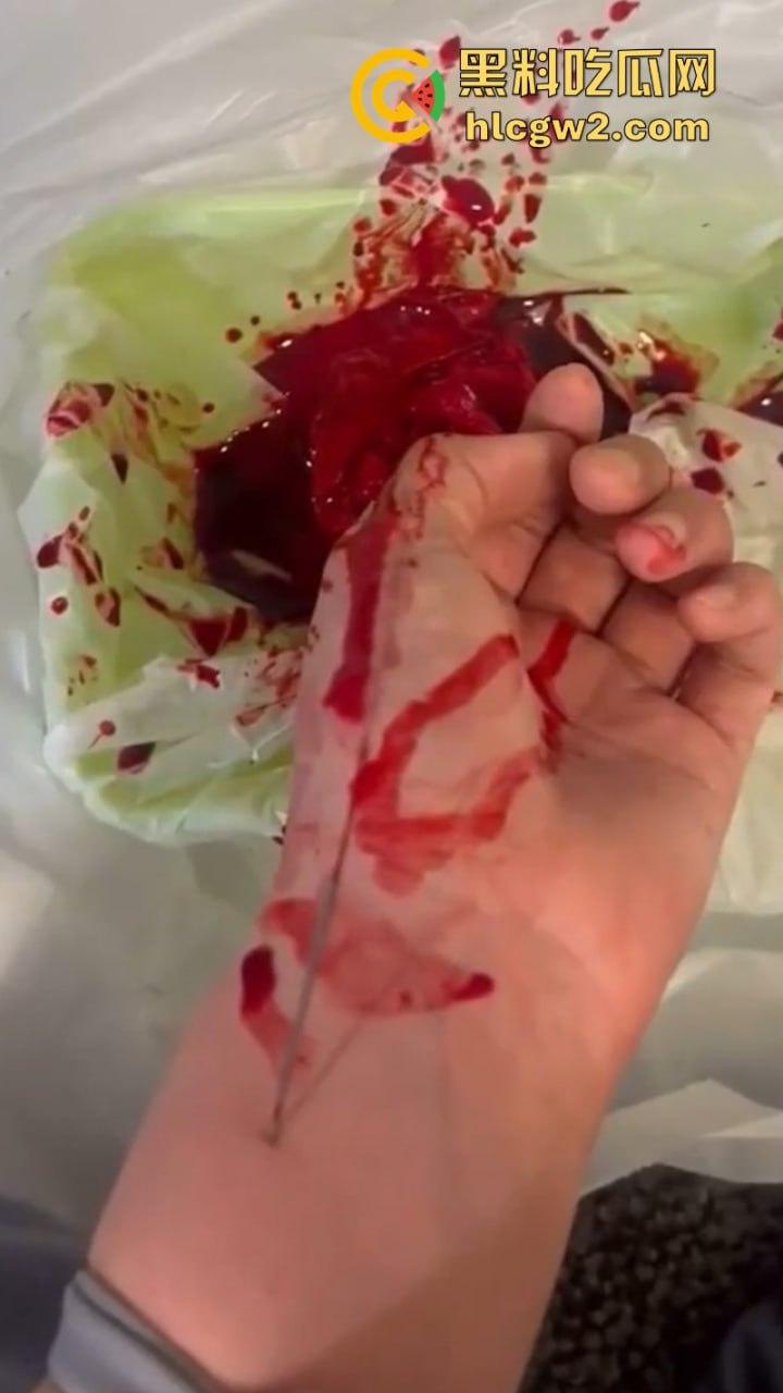 血腥慎入！推特十级脑残血腥自残自拍 残暴割腕引血自流 这是作死还是变态？-1