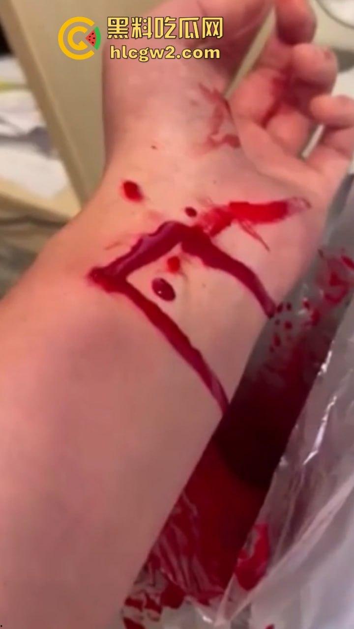 血腥慎入！推特十级脑残血腥自残自拍 残暴割腕引血自流 这是作死还是变态？-5
